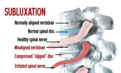What is subluxation?